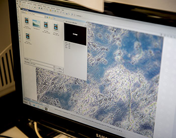 Closeup of a computer screen with an image of a microscopic view.