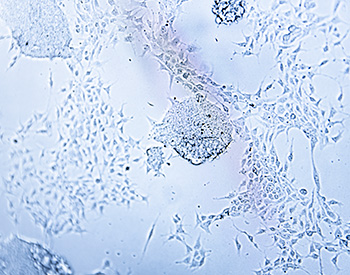 Closeup image of cells.