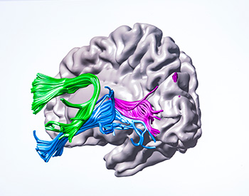 3d illustration of a brain