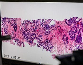 A closeup of a microscopic image on a computer screen.